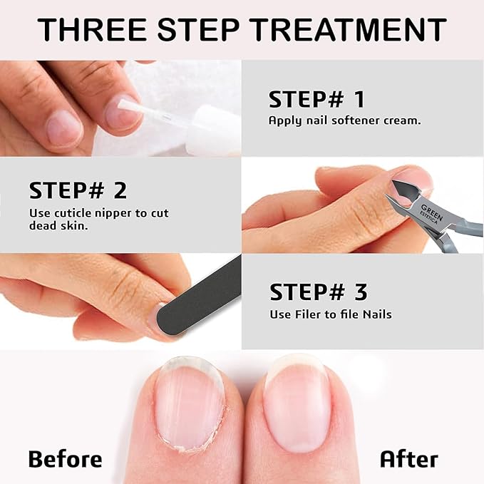 Professional Cuticle Trimmer Nail Cuticle Cutter Stainless Steel Cuticle Nippers with Sharp Blades of Cuticle Remover Clippers Manicure Tools Double Spring for Nail Care Pedicure Nail Tools (Gray)