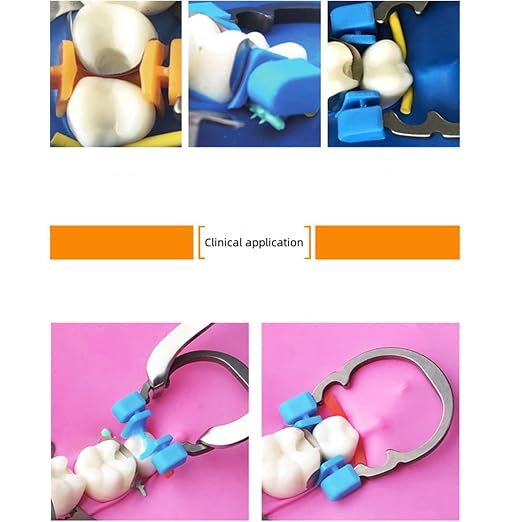 Dental Sectional Matrix Ring Clamp Spring Clip, Autoclavable Nickel Titanium Orthodontic Clamp Rings, Contoured Matrices System for Pre and Post Molars. (R2 Orange)