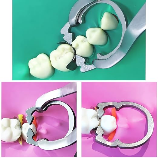 Dental Matrices Clamp Ring, R1 Nickel Titanium Elastic Clamping Ring Separator Ring, Sectional Contoured Matrix Clips Autoclavable Dentistry Tools (Metal R1 1pcs)
