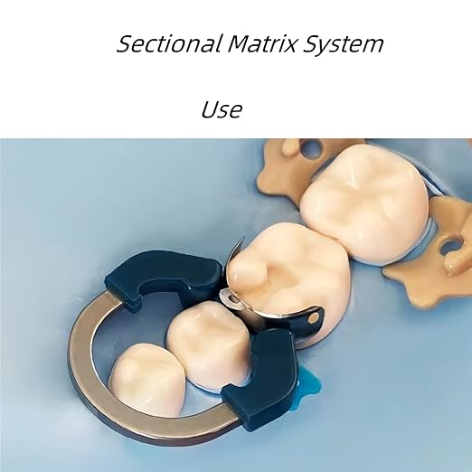 Dental Sectional Matrix System, R6 Nickel Titanium Dental Matrices Clamp Clip Ring, Sectional Contoured Matrix Ring, Autoclavable Dentistry Tools