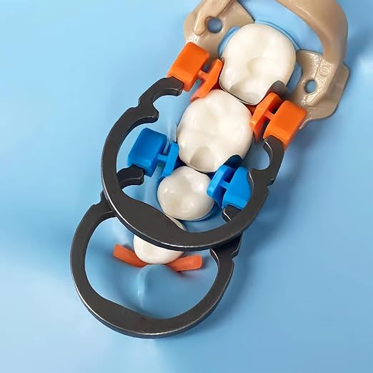 Dental Matrices Clamp Ring, R2 Nickel Titanium Elastic Clamping Ring Separator Ring, Sectional Contoured Matrix Clips Autoclavable Dentistry Tools (Blue R2 1PCS)