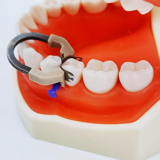 Dental Sectional Matrix Ring Clamp Spring Clip, Autoclavable Nickel Titanium Orthodontic Clamp Rings, Dental Sectional Contoured Matrices System for Pre and Post Molars (R6 Light Brown)