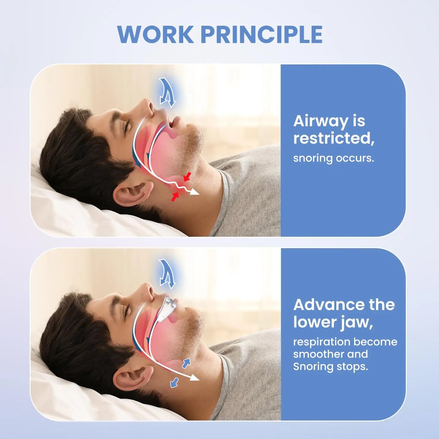 Anti Snoring Mouth Guard | Dental Night Guard for Bruxism and Sleep Aid