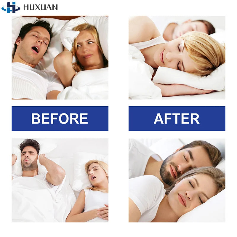 Stop Snoring Patch | Gentle Mouth Tape for Better Sleep and Nose Breathing