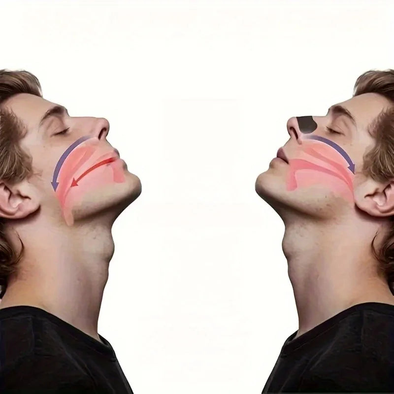 20 Anti-Snoring Nose Strips | Sleep Aid for Easier Breathing