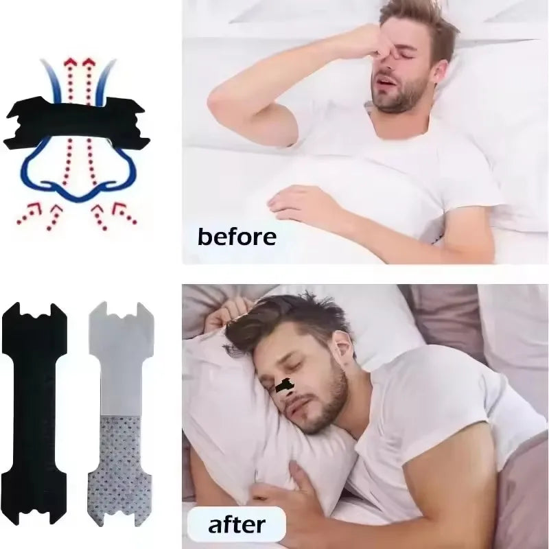 Anti Snoring Nasal Strips | Better Breathing and Restful Sleep Aid