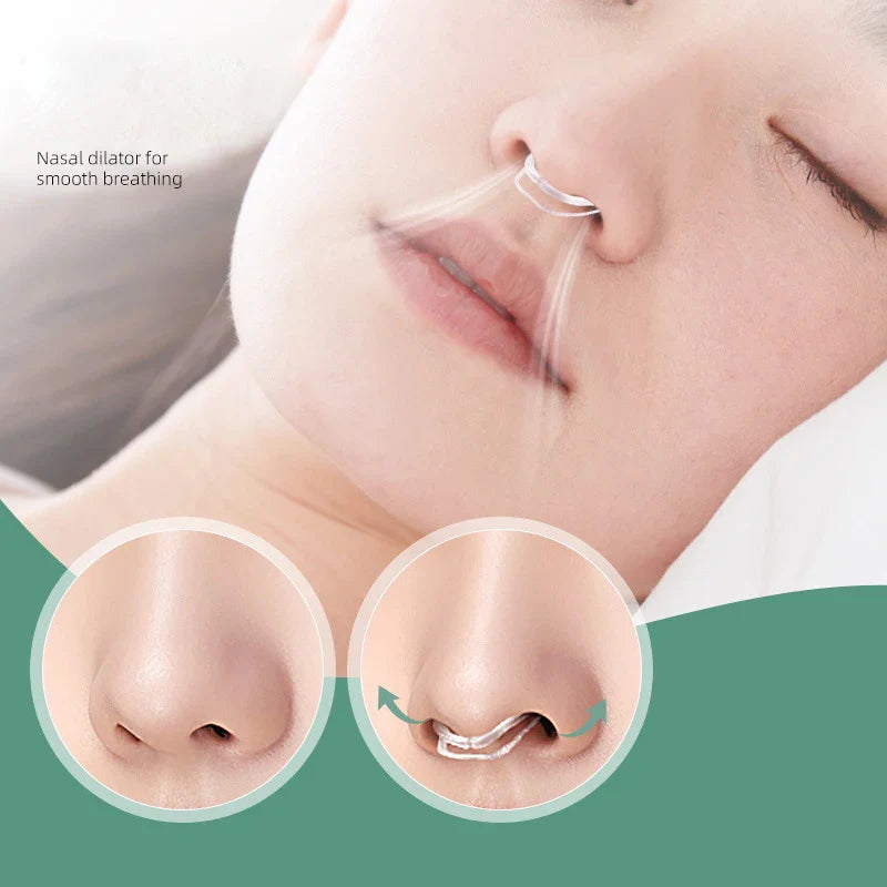 Anti-Snore Nose Clip Device | Nasal Dilator for Better Sleep and Quiet Nights