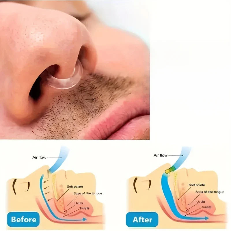 Super Soft Anti-Snoring Device | Nose Hanging Clip for Quiet Sleep