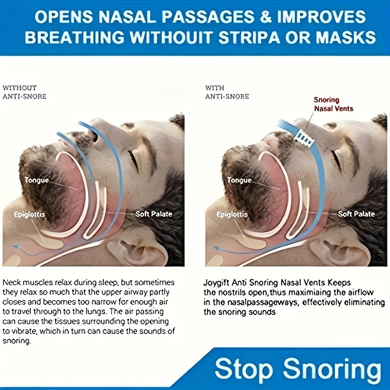 8-Color Anti-Snoring Nose Clip | No-Electricity Sleep Aid