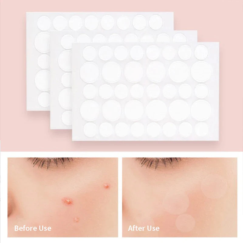 Acne Pimple Patch Invisible Waterproof | Hydrocolloid Spot Treatment for Blemishes