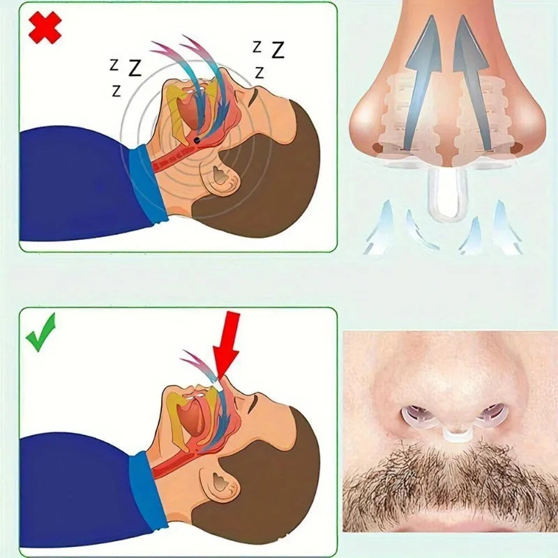 Mini Nasal Expander | Portable Anti-Snoring Nose Clip for Better Sleep