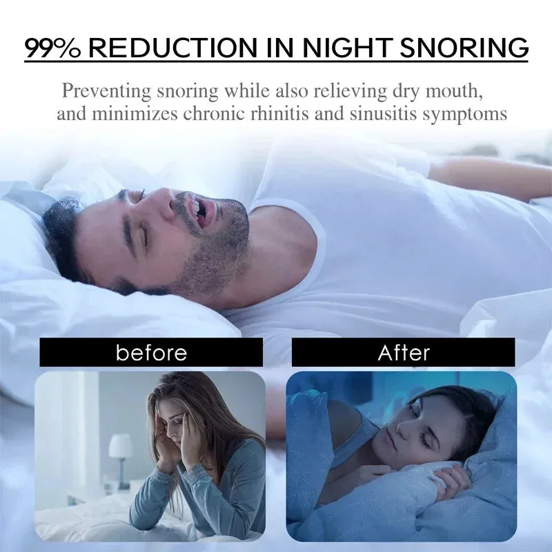 Anti-Snoring Mouth Patches | Sleep Tape for Nasal Breathing