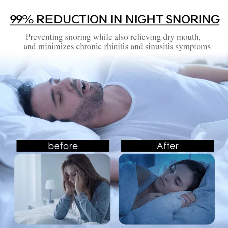 50pcs Black Mouth Tape for Snoring | Anti-Snore Sleep Aid