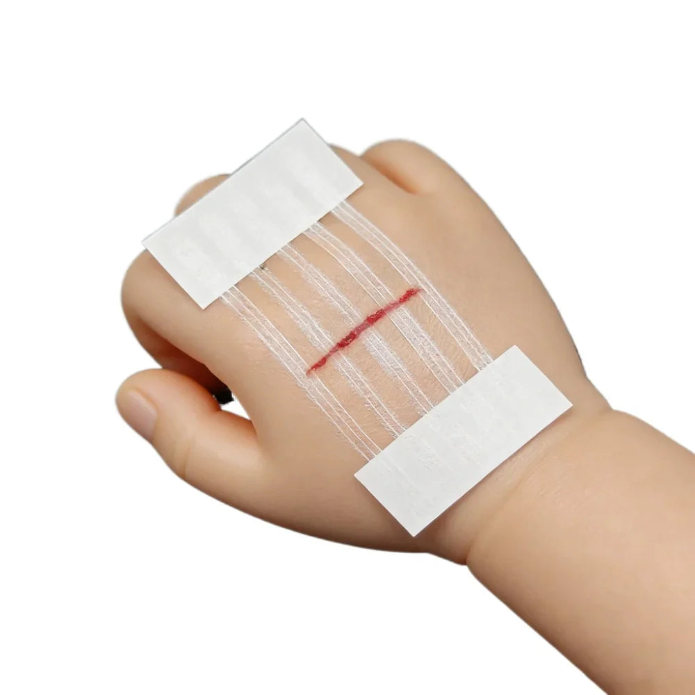 5 Strips Wound Skin Closure Strips | Medical Suture Free Surgical Tape